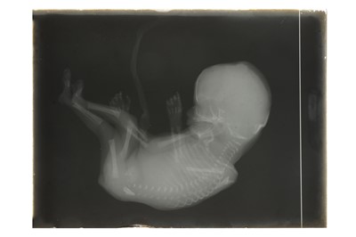 Lot 258 - A Half Plate X-Ray of a Human Foetus