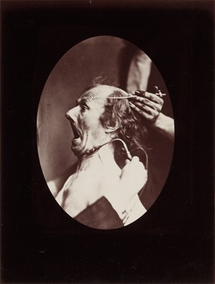 Lot 4 - Guillaume Benjamin Duchenne de Boulogne (1806-1875)