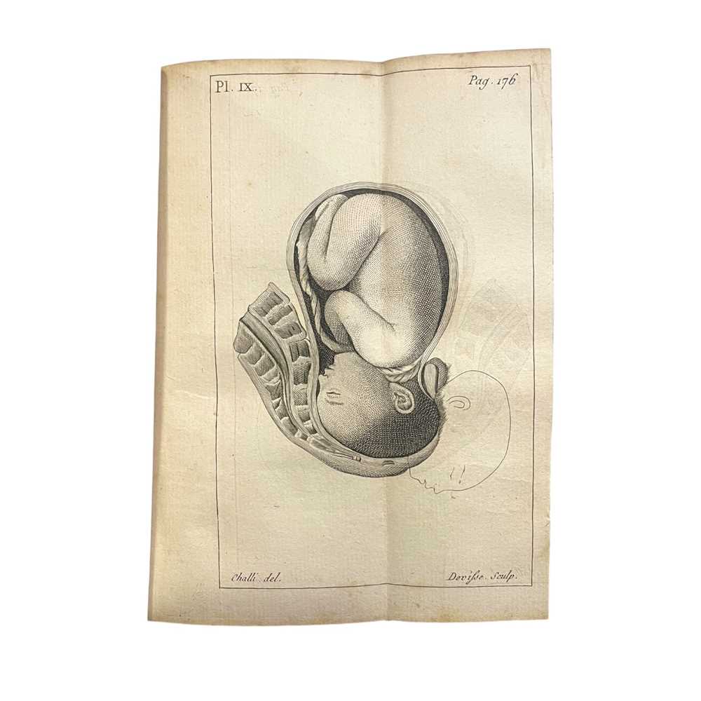 Lot 157 - Obstetrics: Baudelocque (Jean-Louis)